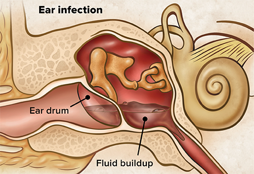 Eardoc